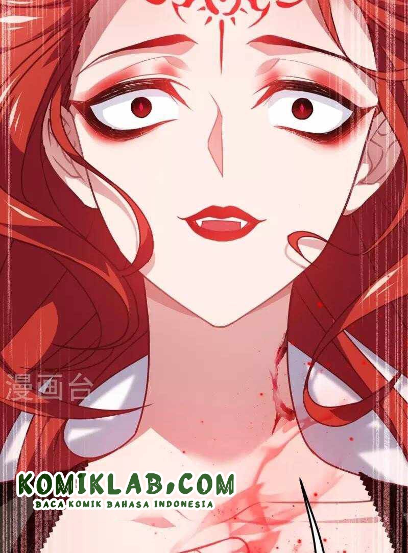 Became King After Being Bitten Chapter 22 Gambar 29