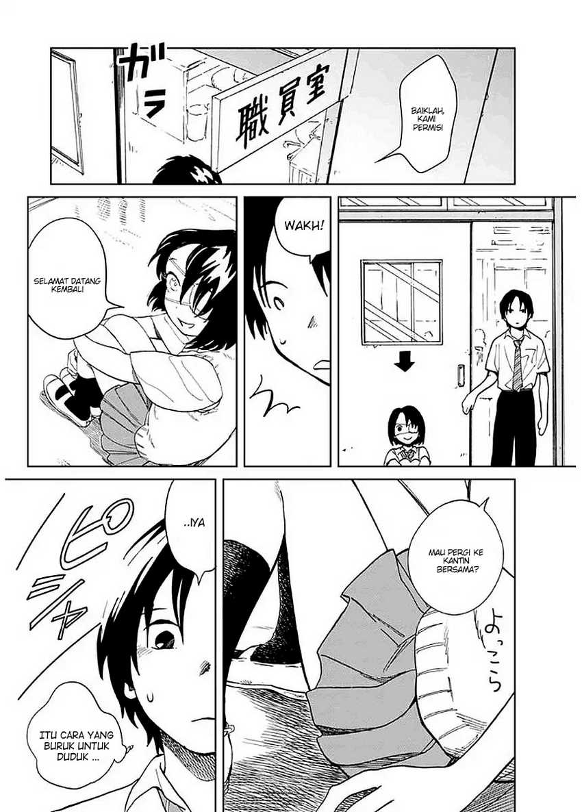 Yakedo Shoujo Chapter 04 Gambar 17