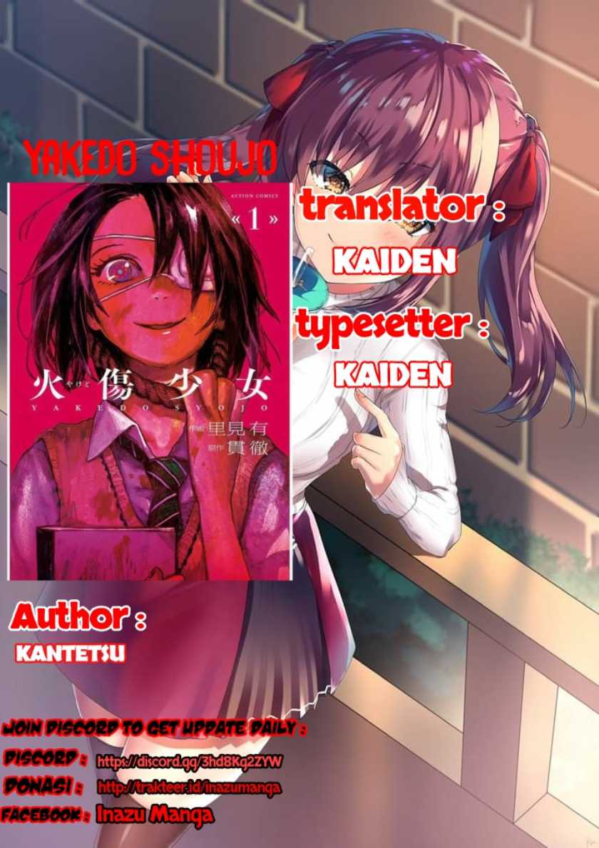 Baca Yakedo Shoujo Chapter 03 Gambar 2
