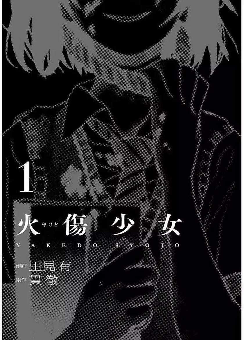 Yakedo Shoujo Chapter 01 3