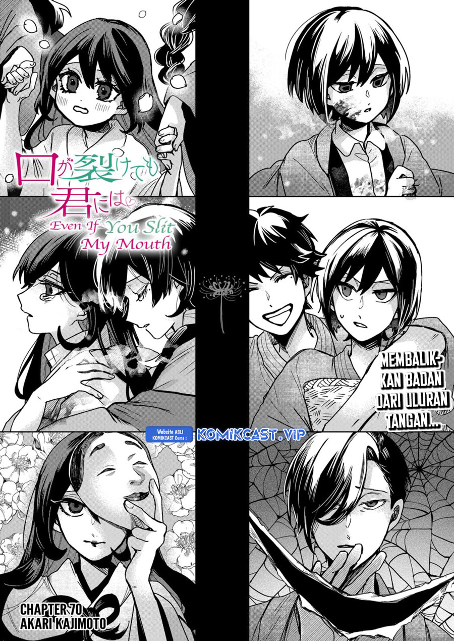 Kuchi ga Saketemo Kimi ni wa Chapter 70 Gambar 9